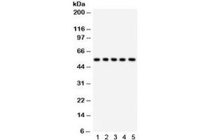 Western blot testing of 1) rat liver, 2) rat testis, 3) human HeLa, 4) RH35, and 5) HEPA lysate with SSH3BP1 antibody. (ABI1 anticorps)