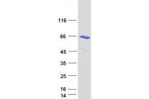 Validation with Western Blot