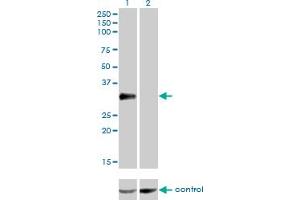 Western blot analysis of CRX over-expressed 293 cell line, cotransfected with CRX Validated Chimera RNAi (Lane 2) or non-transfected control (Lane 1). (CRX anticorps  (AA 1-300))