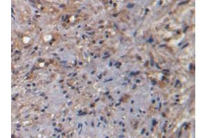 DAB staining on IHC-P; Samples: Human Prostate Tissue) (NKA anticorps)