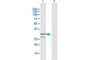 Western Blot analysis of ENDOG expression in transfected 293T cell line by ENDOG MaxPab polyclonal antibody. (Endonuclease G anticorps  (AA 50-297))