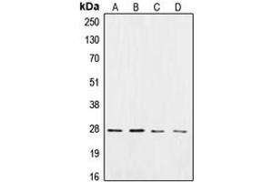 Western blot analysis of CK2 beta expression in HeLa (A), Jurkat (B), mouse brain (C), rat brain (D) whole cell lysates. (CSNK2B anticorps  (C-Term))