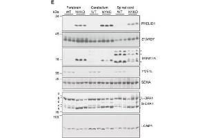 Defective proteostasis and accelerated OPA1 processing in brain and spinal cord of NYKO miceATEM analysis of sagittal spinal cord sections of 6- to 7-week-old WT and NYKO mice.