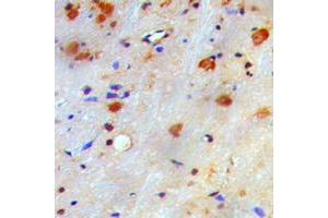 Immunohistochemical analysis of nm23-H1 staining in human brain formalin fixed paraffin embedded tissue section. (NME1 anticorps  (Center))