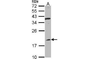 WB Image Sample(30 ug whole cell lysate) A:Raji , 12% SDS PAGE antibody diluted at 1:1000 (IFNA8 anticorps)