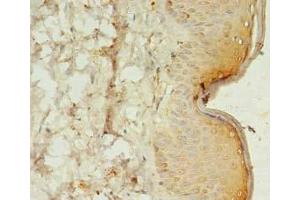 Immunohistochemistry of paraffin-embedded human skin tissue using ABIN7170464 at dilution of 1:100 (SPANXC anticorps  (AA 1-97))