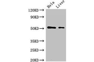 Western Blot Positive WB detected in: Hela whole cell lysate, Rat liver tissue All lanes: SLC10A3 antibody at 2 μg/mL Secondary Goat polyclonal to rabbit IgG at 1/50000 dilution Predicted band size: 51, 48 kDa Observed band size: 51 kDa (SLC1A3 anticorps  (AA 7-151))