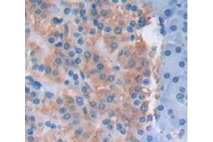 IHC-P analysis of Human Tissue, with DAB staining. (PLOD2 anticorps  (AA 644-737))
