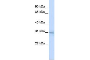 WB Suggested Anti-METTL5 Antibody Titration: 0. (METTL5 anticorps  (N-Term))