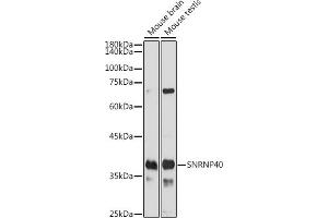Western blot analysis of extracts of various cell lines, using SNRNP40 antibody (ABIN7270361) at 1:1000 dilution.
