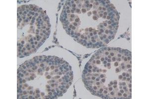 Used in DAB staining on fromalin fixed paraffin- embedded testis tissue (DOK1 anticorps  (AA 18-237))
