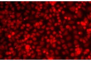 Immunofluorescence analysis of MCF7 cells using ILF2 Polyclonal Antibody (ILF2 anticorps)
