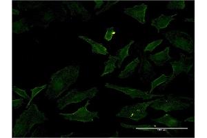 Immunofluorescence of monoclonal antibody to BRAF on HeLa cell. (BRAF anticorps  (AA 138-231))