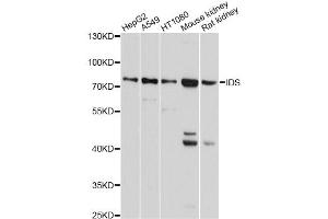 Western blot analysis of extracts of various cell lines, using IDS antibody. (IDS anticorps)