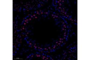 Immunofluorescence of paraffin embedded rat testis using tfiib (ABIN7074034) at dilution of 1: 500 (250x lens) (GTF2B anticorps)