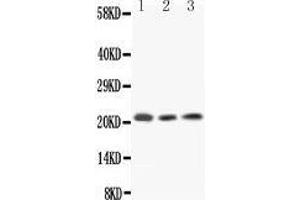 Western Blotting (WB) image for anti-Interleukin 18 (IL18) (AA 37-194) antibody (ABIN3042518) (IL-18 anticorps  (AA 37-194))