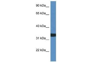 Western Blot showing ACER1 antibody used at a concentration of 1 ug/ml against HCT15 Cell Lysate (ACER1 anticorps  (C-Term))