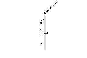 Anti-Z1 Antibody (N-Term)at 1:1000 dilution + human skeletal muscle lysates Lysates/proteins at 20 μg per lane. (AMZ1 anticorps  (AA 65-96))