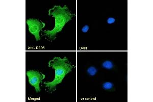 (ABIN334388) Immunofluorescence analysis of paraformaldehyde fixed U251 cells, permeabilized with 0. (DRD5 anticorps  (Internal Region))
