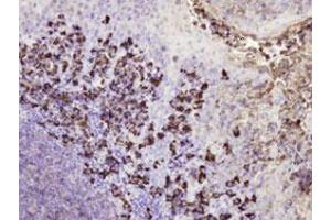 Immunohistochemical staining (Formalin-fixed paraffin-embedded sections) of human tonsil with Human IgG monoclonal antibody, clone E20-V . (Lapin anti-Humain Immunoglobulin Heavy Constant gamma 1 (G1m Marker) (IGHG1) (Internal Region) Anticorps)