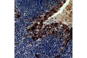 Immunohistochemical analysis of CD21 staining in human tonsil formalin fixed paraffin embedded tissue section. (CD21 anticorps)