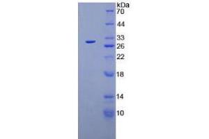SDS-PAGE analysis of Mouse Plasminogen Protein.