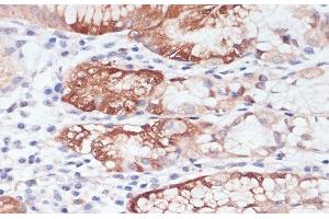 Immunohistochemistry of paraffin-embedded Human stomach using LYZ Polyclonal Antibody at dilution of 1:100 (40x lens). (LYZ anticorps)