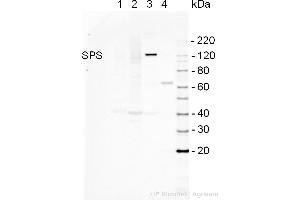 Western Blotting (WB) image for anti-Sucrose Phosphate Synthase (SPS) antibody (ABIN2559391) (Sucrose Phosphate Synthase anticorps)
