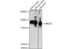 Western blot analysis of extracts of various cell lines, using LRRC61 Rabbit pAb (ABIN7268223) at 1:1000 dilution. (LRRC61 anticorps  (AA 1-259))