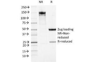 SDS-PAGE Analysis Purified ATRX Mouse Monoclonal Antibody (23c). (ATRX anticorps)