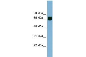 WB Suggested Anti-RIC8B Antibody Titration: 0. (RIC8B anticorps  (Middle Region))