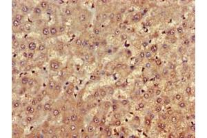 Immunohistochemistry of paraffin-embedded human liver tissue using ABIN7152690 at dilution of 1:100 (FARP1 anticorps  (AA 1-300))
