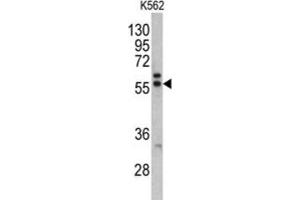 Western Blotting (WB) image for anti-Preferentially Expressed Antigen in Melanoma (PRAME) antibody (ABIN5022672) (PRAME anticorps)