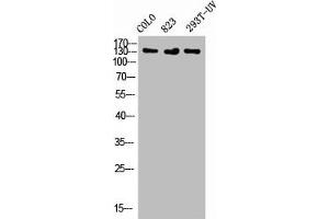 Western Blot analysis of COLO 823 293T-UV cells using Phospho-Flt-1 (Y1048) Polyclonal Antibody (FLT1 anticorps  (pTyr1048))