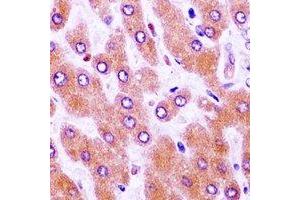 Immunohistochemistry (IHC) image for anti-Wilms Tumor 1 (WT1) antibody (ABIN7308510) (WT1 anticorps)
