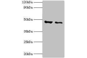Western blot All lanes: PLIN2 antibody at 4 μg/mL Lane 1: HepG2 whole cell lysate Lane 2: Hela whole cell lysate Secondary Goat polyclonal to rabbit IgG at 1/10000 dilution Predicted band size: 48 kDa Observed band size: 48 kDa (ADRP anticorps  (AA 168-437))