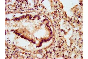 IHC image of ABIN7153633 diluted at 1:500 and staining in paraffin-embedded human lung tissue performed on a Leica BondTM system.