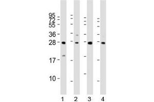 Western blot analysis of LIN28B antibody and 1) HeLa, 2) K562, 3) mouse testis and 4) NCCIT lysate.