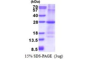 SDS-PAGE (SDS) image for Glutathione S-Transferase mu 1 (GSTM1) (AA 1-181) protein (His tag) (ABIN5853613)