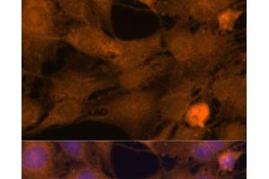 Immunofluorescence analysis of C6 cells using ZC3H7A Polyclonal Antibody at dilution of 1:100.