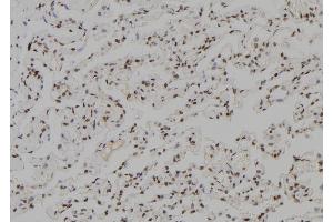 ABIN6279505 at 1/100 staining Human lung tissue by IHC-P. (TGIF2LX anticorps)