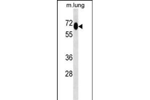 MEPCE Antibody (Center) (ABIN657029 and ABIN2846203) western blot analysis in mouse lung tissue lysates (35 μg/lane). (MEPCE anticorps  (AA 239-267))
