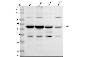 Western blot analysis of RRM2 using anti-RRM2 antibody (ABIN7606215).