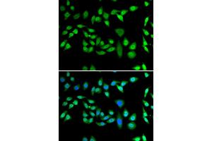 Immunofluorescence analysis of U2OS cells using DNAJB6 antibody. (DNAJB6 anticorps)