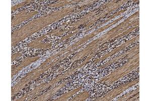 IHC analysis of EIF5 using anti-EIF5 antibody (ABIN7599722). (EIF5 anticorps  (AA 11-423))