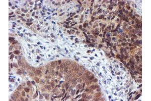 Image no. 5 for anti-RuvB-Like 2 (E. Coli) (RUVBL2) (AA 113-370) antibody (ABIN1490851)