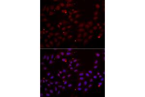 Immunofluorescence analysis of HeLa cells using CST2 antibody. (CST2 anticorps)
