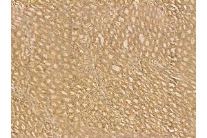 ACAD9 Mouse Monoclonal Antibody at 1/100 staining rat kidney tissue by IHC-P. (ACAD9 anticorps  (Internal Region))