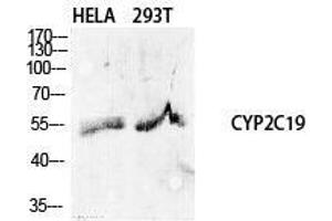 Western Blot (WB) analysis of specific cells using CYP2C19 Polyclonal Antibody. (CYP2C19 anticorps  (Internal Region))