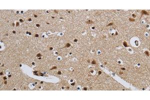 Immunohistochemistry of paraffin-embedded Human brain tissue using CMTM8 Polyclonal Antibody at dilution 1:40 (CMTM8 anticorps)